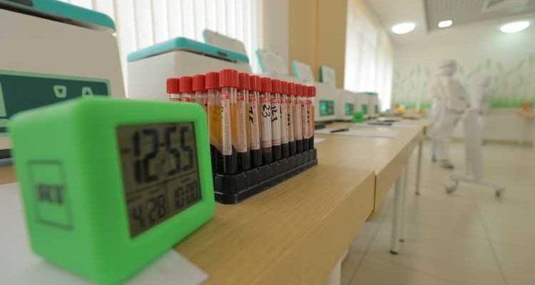 «Инвитро» запускает новый высокочувствительный тест на антитела к коронавирусу с возможностью исполнения за 4 часа